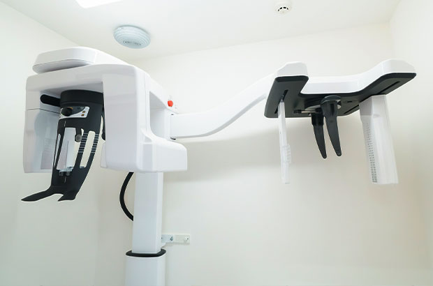 矯正治療には必須の設備機器『セファロ（CT）』を完備