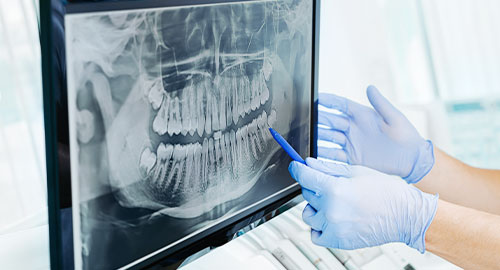親知らずの抜歯や顎関節症、口腔内疾患の専門治療が受診できます