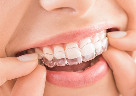 歯科矯正専門サイト
